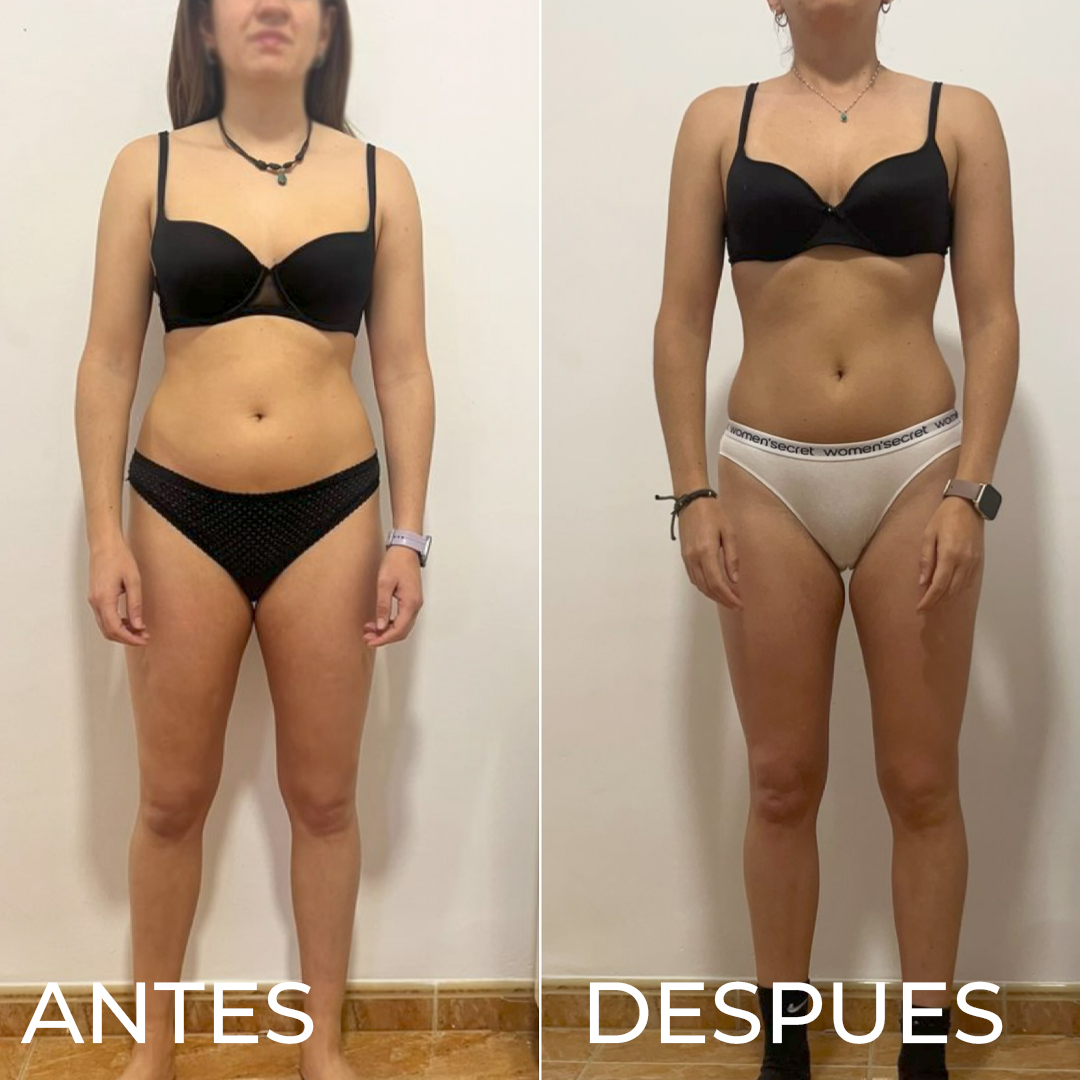 ANAHIGUERAS